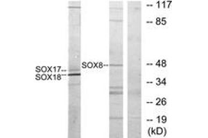 Western blot analysis of extracts from COS7 cells, treated with serum 10% 30', using SOX8/9/17/18 Antibody. (SOX8/9/17/18 抗体  (AA 116-165))