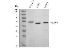 Western blot analysis of KCNN4 using anti-KCNN4 antibody (ABIN3043233).
