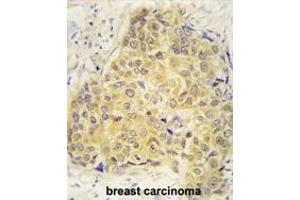Immunohistochemistry (Paraffin-embedded Sections) (IHC (p)) image for anti-Sema Domain, Immunoglobulin Domain (Ig), Short Basic Domain, Secreted, (Semaphorin) 3A (SEMA3A) (AA 535-566) antibody (ABIN392177)