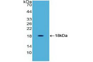 Western blot analysis of recombinant Human HMGA1. (HMGA1 抗体  (AA 3-107))