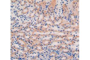 IHC-P analysis of kidney tissue, with DAB staining. (IL11RA 抗体  (AA 59-217))