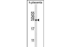 CRYBA1 Antibody (Center) (ABIN656311 and ABIN2845613) western blot analysis in human placenta tissue lysates (35 μg/lane). (CRYBA1 抗体  (AA 104-133))