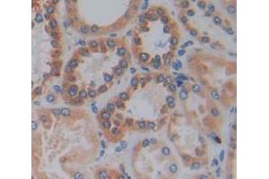 Used in DAB staining on fromalin fixed paraffin- embedded Kidney tissue (HPS4 抗体  (AA 6-192))