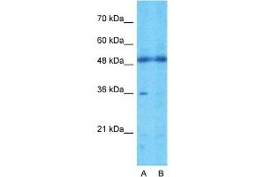 Host:  Rabbit  Target Name:  TMEM30A  Sample Type:  721_B  Lane A:  Primary Antibody  Lane B:  Primary Antibody + Blocking Peptide  Primary Antibody Concentration:  1ug/ml  Peptide Concentration:  5ug/ml  Lysate Quantity:  25ug/lane/lane  Gel Concentration:  0. (TMEM30A 抗体  (Middle Region))