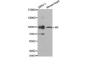 Western blot analysis of extracts of 22RV1 and mouse heart  cell lines, using AR antibody.
