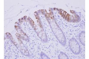 IHC-P Image Biglycan antibody detects BGN protein at cytosol on human Colon Epithelium by immunohistochemical analysis. (Biglycan 抗体)