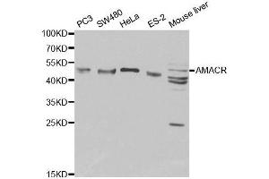 Western blot analysis of extracts of various cell lines, using AMACR antibody. (AMACR 抗体  (AA 1-198))