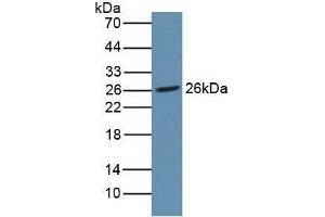 NOG 抗体  (AA 28-232)