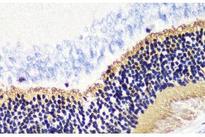 Immunohistochemistry of paraffin-embedded Rat retina using PDC Polyclonal Antibody at dilution of 1:200 (40x lens). (Phosducin 抗体)
