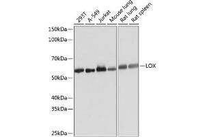 Western blot analysis of extracts of various cell lines, using LOX Rabbit mAb (ABIN7268347) at 1:1000 dilution. (LOX 抗体)
