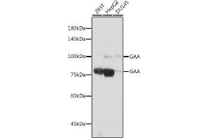 Western blot analysis of extracts of various cell lines, using GAA antibody (ABIN7267404) at 1:1000 dilution. (GAA 抗体)