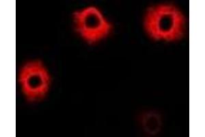 Immunofluorescent analysis of PIP4K2 beta staining in A549 cells. (PIP4K2B 抗体)