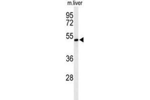 Western Blotting (WB) image for anti-Zinc Finger, DHHC-Type Containing 9 (ZDHHC9) (AA 335-364), (C-Term) antibody (ABIN955656)