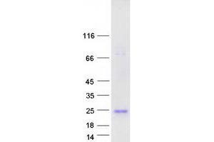 Western Blotting (WB) image for Interferon, alpha 5 (IFNA5) protein (Myc-DYKDDDDK Tag) (ABIN2723321)