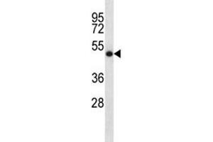 SOCS4 antibody western blot analysis in NCI-H460 lysate. (SOCS4 抗体  (AA 224-253))