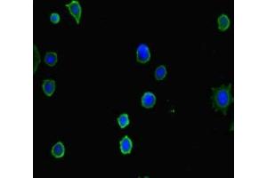 Immunofluorescent analysis of MCF-7 cells using ABIN7155318 at dilution of 1:100 and Alexa Fluor 488-congugated AffiniPure Goat Anti-Rabbit IgG(H+L) (HDAC5 抗体  (AA 1-100))