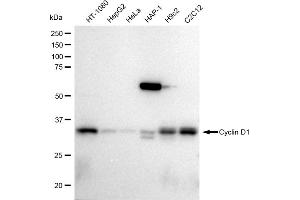 Western blotting analysis using Cyclin D1 antibody (ABIN7798194). (Recombinant Cyclin D1 抗体)