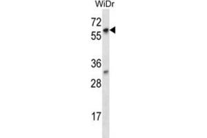 Western Blotting (WB) image for anti-La Ribonucleoprotein Domain Family, Member 7 (LARP7) antibody (ABIN2997066) (LARP7 抗体)