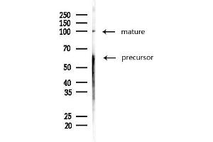 Western blot analysis of lysates from MDA-MB-231 cells(heat-shock,45 min treatment), using C Antibody at 1/1000 dilution.