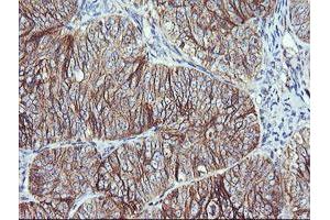 Image no. 2 for anti-V-Ral Simian Leukemia Viral Oncogene Homolog B (Ras Related, GTP Binding Protein) (Ralb) antibody (ABIN1500584) (RALB 抗体)