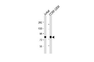 All lanes : Anti-MYB Antibody (Center) at 1:2000 dilution Lane 1: Jurkat whole cell lysate Lane 2: CCRF-CEM whole cell lysate Lysates/proteins at 20 μg per lane. (MYB 抗体  (AA 1-185))