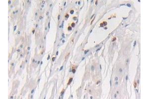 Immunohistochemistry (IHC) image for anti-Sema Domain, Immunoglobulin Domain (Ig), Short Basic Domain, Secreted, (Semaphorin) 3E (SEMA3E) (AA 32-516) antibody (ABIN7430111)