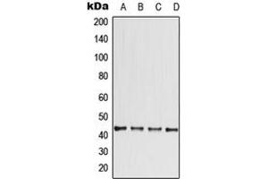 Western blot analysis of CCBE1 expression in ACHN (A), HeLa (B), SP2/0 (C), PC12 (D) whole cell lysates. (CCBE1 抗体  (Center))