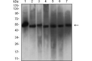 Western Blotting (WB) image for anti-Calreticulin (CALR) (AA 18-417) antibody (ABIN7193510)