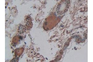 Used in DAB staining on fromalin fixed paraffin- embedded intestine tissue (CPB2 抗体  (AA 113-422))