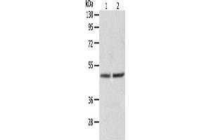 Western Blotting (WB) image for anti-Alanine Glyoxylate Aminotransferase (AGXT) antibody (ABIN2426537) (AGXT 抗体)