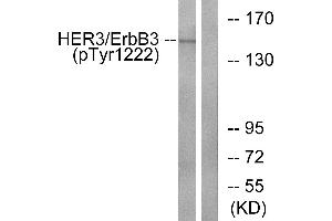 Western blot analysis of extracts from HUVEC cells, treated with EGF (200ng/ml, 30mins), using HER3/ErbB3 (Phospho-Tyr1222) antibody. (ERBB3 抗体  (pTyr1222))