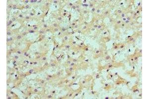 Immunohistochemistry (IHC) image for anti-Sulfotransferase Family, Cytosolic, 2A, Dehydroepiandrosterone (DHEA)-Preferring, Member 1 (SULT2A1) (AA 1-145) antibody (ABIN7145593)