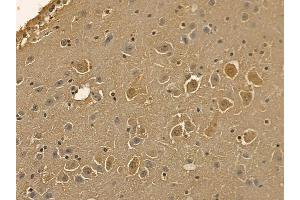 NMDAR2B Mouse Monoclonal Antibody at 1/100 staining mouse brain tissue by IHC-P.