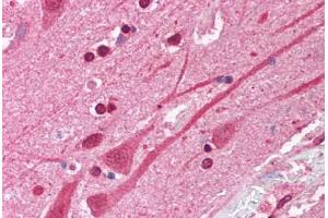 Human Brain, Cortex (formalin-fixed, paraffin-embedded) stained with ATF1 antibody ABIN214086 at 5 ug/ml followed by biotinylated goat anti-rabbit IgG secondary antibody ABIN481713, alkaline phosphatase-streptavidin and chromogen. (AFT1 抗体  (N-Term))