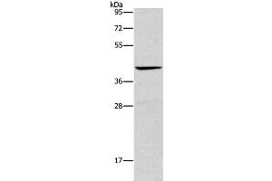 Western Blot analysis of Mouse liver tissue using ORM2 Polyclonal Antibody at dilution of 1:500 (Orosomucoid 2 抗体)