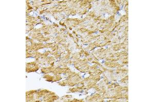 Immunohistochemistry (IHC) image for anti-Solute Carrier Family 25 (Mitochondrial Carrier, Adenine Nucleotide Translocator), Member 5 (SLC25A5) (AA 150-250) antibody (ABIN7270430)