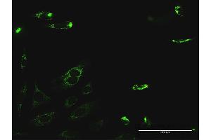 Immunofluorescence of purified MaxPab antibody to PYCR2 on HeLa cell. (PYCR2 抗体  (AA 1-320))