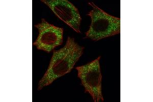 Fluorescent image of C2C12 cell stained with BRAF Antibody (Center) (ABIN392246 and ABIN2841936). (SNRPE 抗体  (AA 424-453))