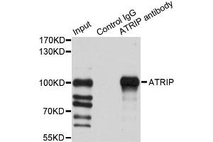 Immunoprecipitation analysis of 200ug extracts of HeLa cells using 1ug ATRIP antibody (ABIN2561292).