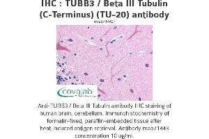 Image no. 3 for anti-Tubulin, beta 3 (TUBB3) (N-Term) antibody (ABIN1724161)