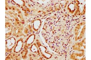 IHC image of ABIN7175958 diluted at 1:300 and staining in paraffin-embedded human kidney tissue performed on a Leica BondTM system. (YY1AP1 抗体  (AA 335-466))