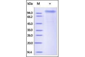 Human COMP, His Tag on SDS-PAGE under reducing (R) condition. (COMP Protein (AA 21-757) (His tag))