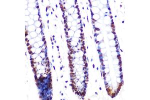 Immunohistochemistry of paraffin-embedded human colon using SRSF1/SRSF1/SF2/ASF Rabbit mAb (ABIN7270213) at dilution of 1:100 (40x lens). (SRSF1 抗体)