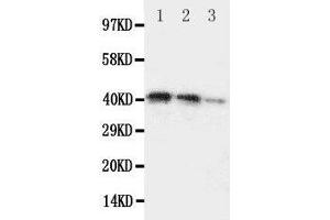 Lane 3: Recombinant Human DDR2 Protein 2. (DDR2 抗体  (C-Term))