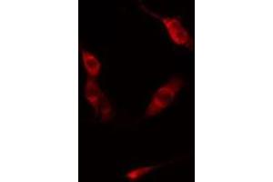 ABIN6275854 staining  Hela cells by IF/ICC. (PKN1 抗体  (Internal Region))