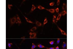 Immunofluorescence analysis of NIH-3T3 cells using PTPN13 Polyclonal Antibody at dilution of 1:100 (40x lens). (PTPN13 抗体)