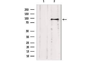 Western blot analysis of extracts from HepG2, using ODF2 antibody. (ODF2 抗体  (Internal Region))