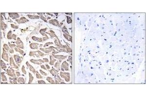 Immunohistochemistry analysis of paraffin-embedded human heart tissue, using BRWD3 Antibody. (BRWD3 抗体  (AA 1751-1800))