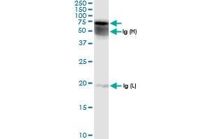 Immunoprecipitation of GALNS transfected lysate using anti-GALNS MaxPab rabbit polyclonal antibody and Protein A Magnetic Bead , and immunoblotted with GALNS MaxPab rabbit polyclonal antibody (D01) . (GALNS 抗体  (AA 1-522))
