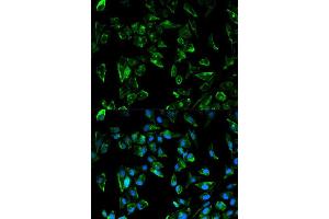 Immunofluorescence analysis of HeLa cell using TPM3 antibody. (TPM3 抗体  (AA 1-284))